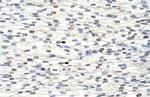 RBM8A Antibody in Immunohistochemistry (Paraffin) (IHC (P))