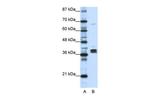 hnRNP DL Antibody in Western Blot (WB)