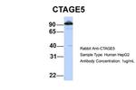 CTAGE5 Antibody in Western Blot (WB)