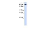 CTAGE5 Antibody in Western Blot (WB)