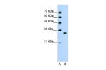 RNAse H2A Antibody in Western Blot (WB)