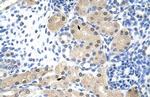 RNAse H2A Antibody in Immunohistochemistry (Paraffin) (IHC (P))