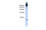 PRP8 Antibody in Western Blot (WB)