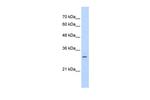 SLBP Antibody in Western Blot (WB)