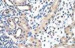 SNRPD1 Antibody in Immunohistochemistry (Paraffin) (IHC (P))