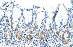 ADAT1 Antibody in Immunohistochemistry (Paraffin) (IHC (P))