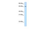 ADAT1 Antibody in Western Blot (WB)