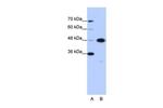 GTPBP9 Antibody in Western Blot (WB)