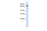 SRP68 Antibody in Western Blot (WB)