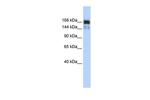 XRN1 Antibody in Western Blot (WB)