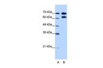 RAVER1 Antibody in Western Blot (WB)