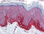 FZD4 Antibody in Immunohistochemistry (IHC)