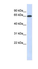 FZD4 Antibody in Western Blot (WB)