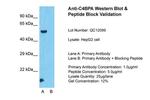C4BPA Antibody in Western Blot (WB)