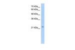 EMP2 Antibody in Western Blot (WB)