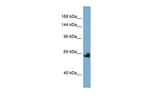 Klotho Antibody in Western Blot (WB)