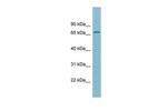 SLC27A5 Antibody in Western Blot (WB)