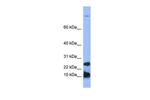 HAMP Antibody in Western Blot (WB)