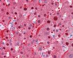 FAH Antibody in Immunohistochemistry (IHC)