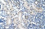 LOR Antibody in Immunohistochemistry (Paraffin) (IHC (P))