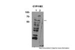 CYP11B2 Antibody in Western Blot (WB)