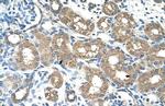 ALAS2 Antibody in Immunohistochemistry (Paraffin) (IHC (P))