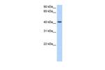 PSG5 Antibody in Western Blot (WB)