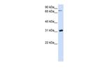 UPP1 Antibody in Western Blot (WB)