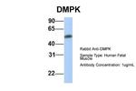 DMPK Antibody in Western Blot (WB)