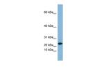 SPRR3 Antibody in Western Blot (WB)