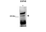 EXPH5 Antibody in Western Blot (WB)