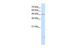 PSD3 Antibody in Western Blot (WB)