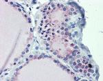 GNAS Antibody in Immunohistochemistry (Paraffin) (IHC (P))