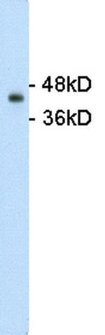 GNAS Antibody in Western Blot (WB)