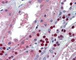 MUPP1 Antibody in Immunohistochemistry (IHC)