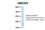 UBE2D3 Antibody in Western Blot (WB)