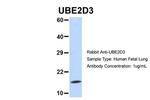 UBE2D3 Antibody in Western Blot (WB)