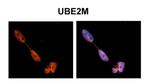 UBE2M Antibody in Immunohistochemistry (IHC)