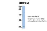 UBE2M Antibody in Western Blot (WB)