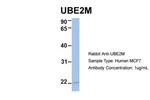 UBE2M Antibody in Western Blot (WB)