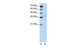 RAPSN Antibody in Western Blot (WB)