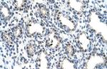 ALY Antibody in Immunohistochemistry (IHC)