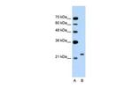 C14orf130 Antibody in Western Blot (WB)