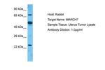 Axotrophin Antibody in Western Blot (WB)