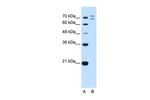 RNF168 Antibody in Western Blot (WB)