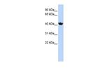 ADH4 Antibody in Western Blot (WB)