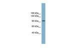 SLC12A3 Antibody in Western Blot (WB)