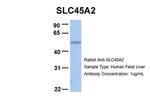 SLC45A2 Antibody in Western Blot (WB)