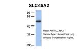 SLC45A2 Antibody in Western Blot (WB)