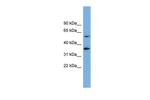 SLC7A7 Antibody in Western Blot (WB)